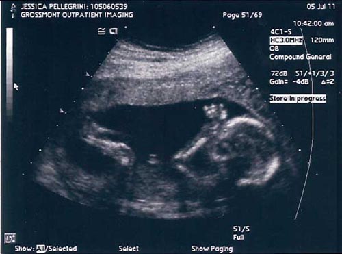 Ava's Ultrasound