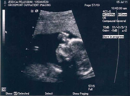 Ava's Ultrasound